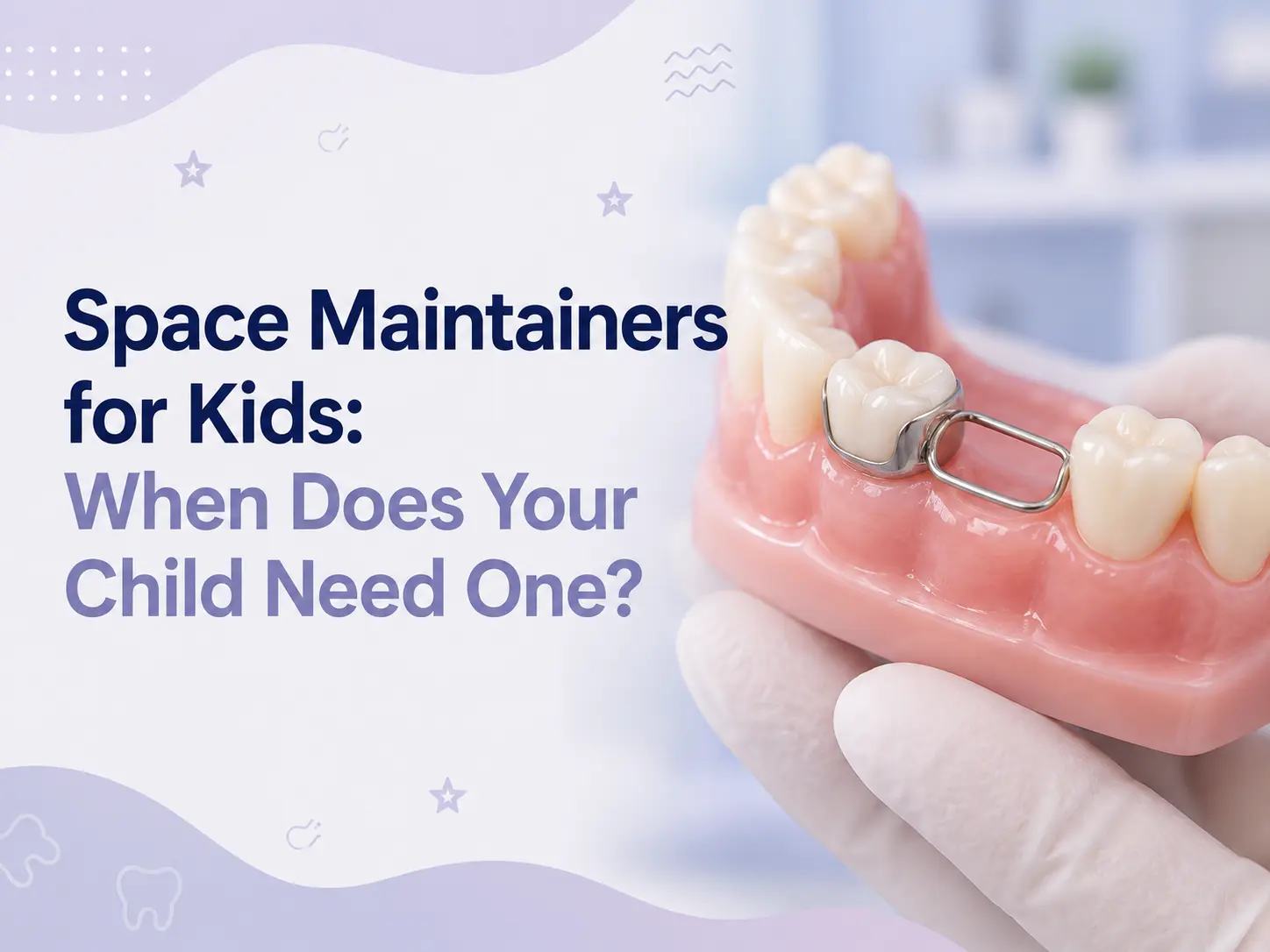 Space Maintainers For Kids: When Does Your Child Need One?