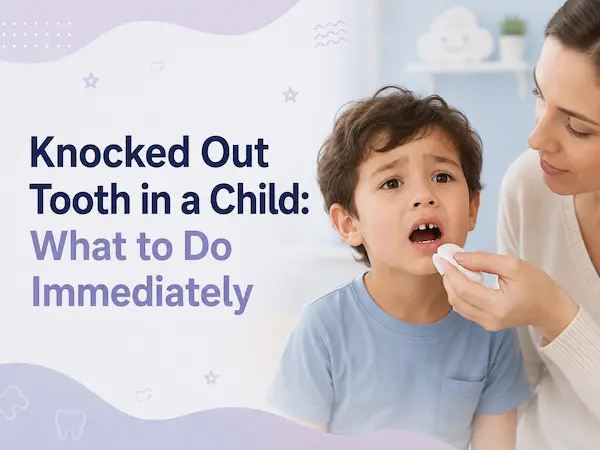 Knocked Out Tooth In A Child: What To Do Immediately